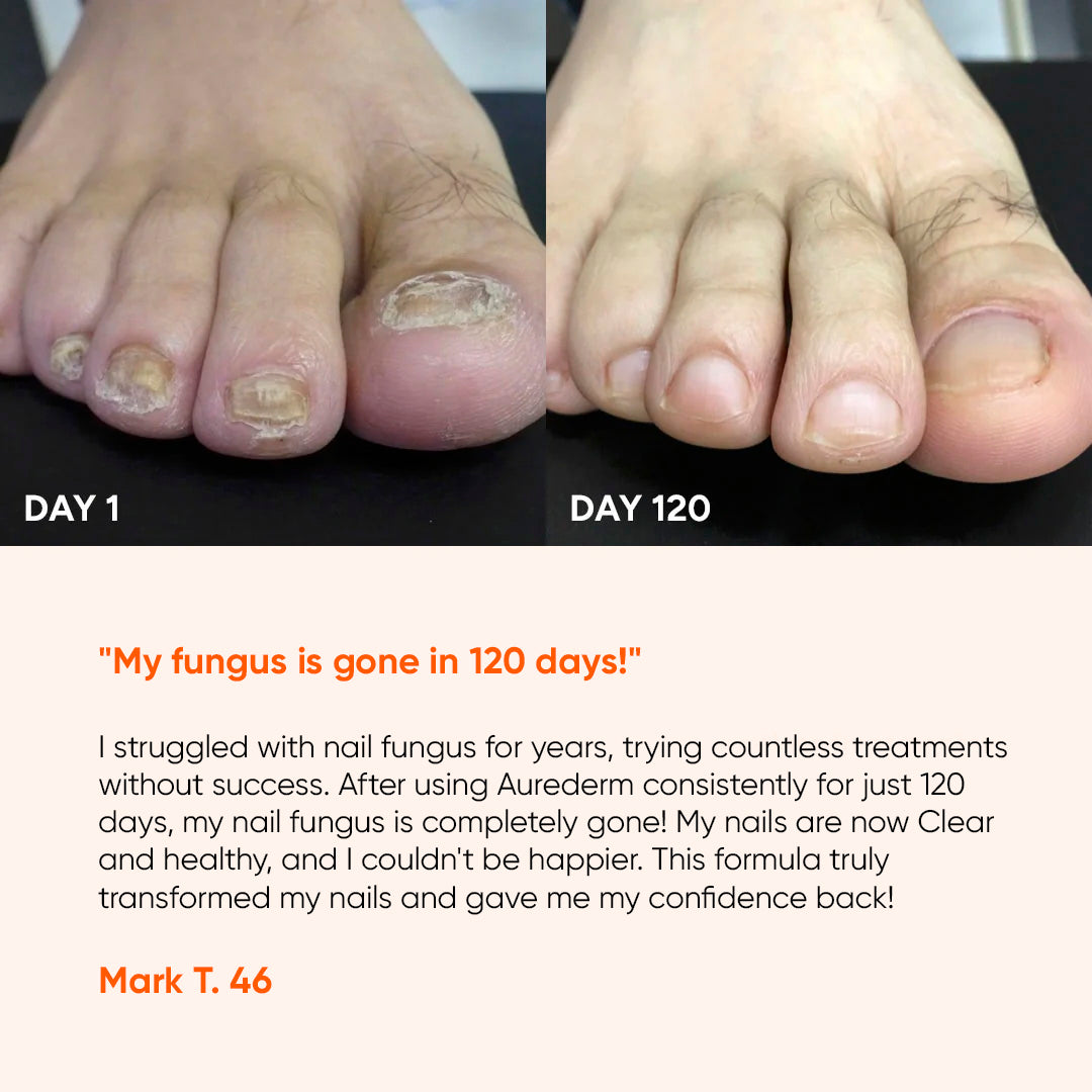 AureDerm™ Daily Nail Clarity Formula