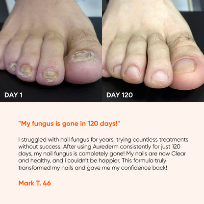 AureDerm™ Daily Nail Clarity Formula